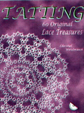 130027-tatting-60-original-lace-treasures